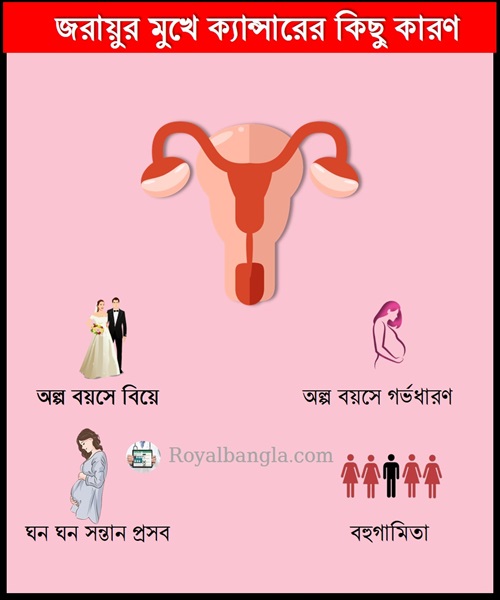 Some Causes of Cervical Cancer.