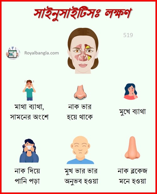 Sinusitis Causes in Bangla