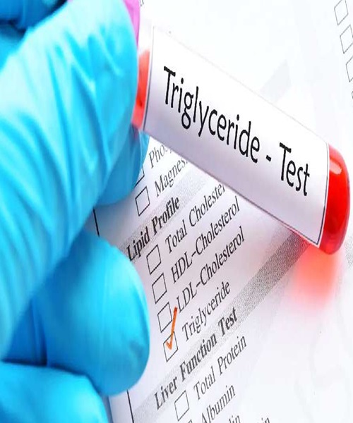 Triglycerides 