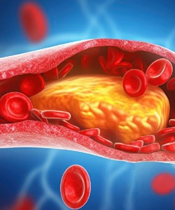 Cholesterol কোলেস্টেরল: ভারসাম্যের চাবিকাঠি